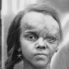 Total Recall